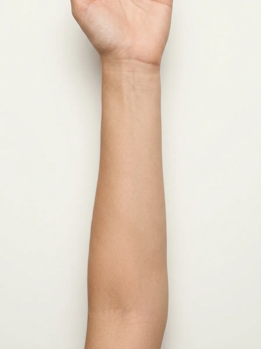 Forearm placement